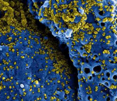 Why the Coronavirus should worry us all
