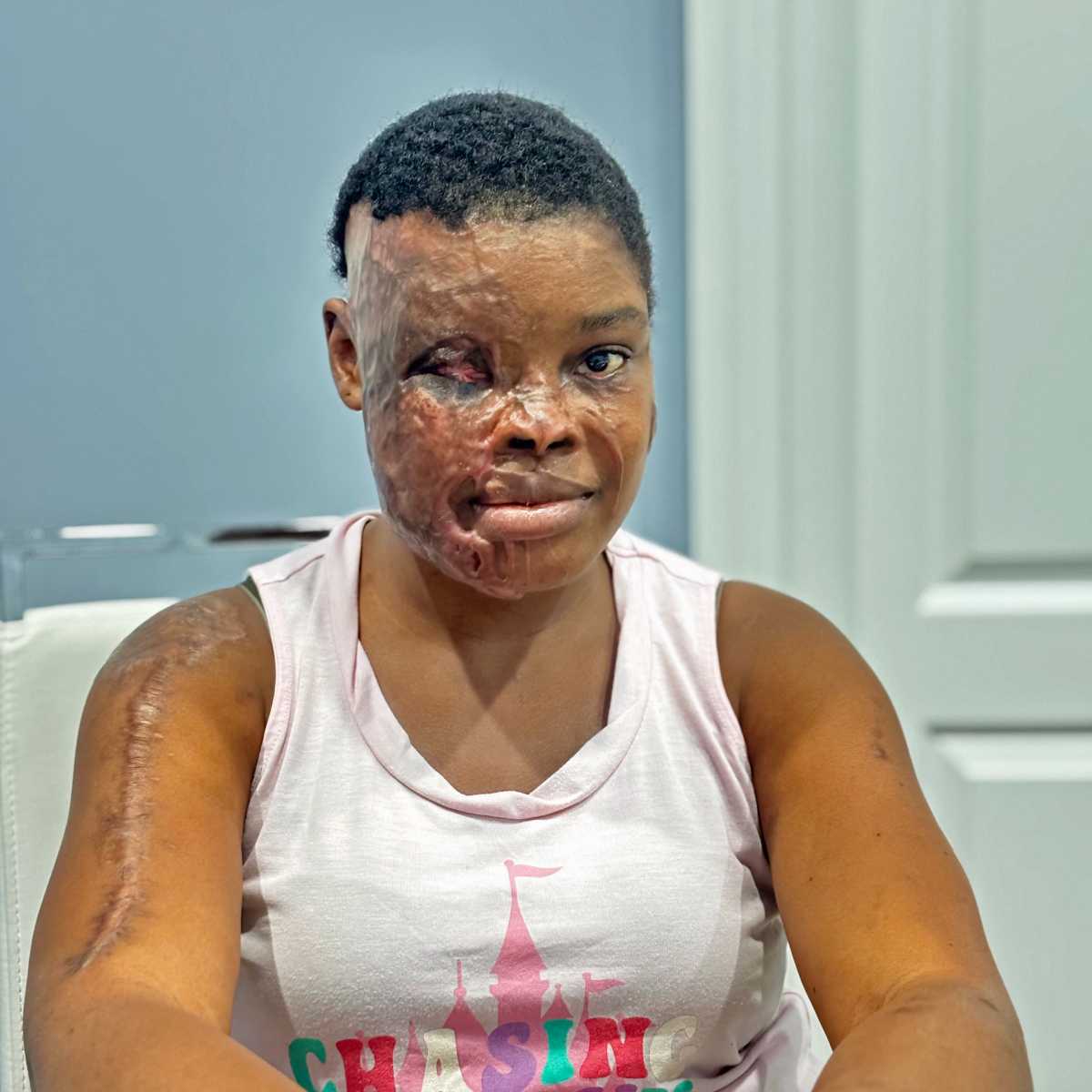 Jilicia Leitch continues her recovery in New York after surviving a brutal acid attack, holding onto faith as she seeks reconstructive surgery and healing.